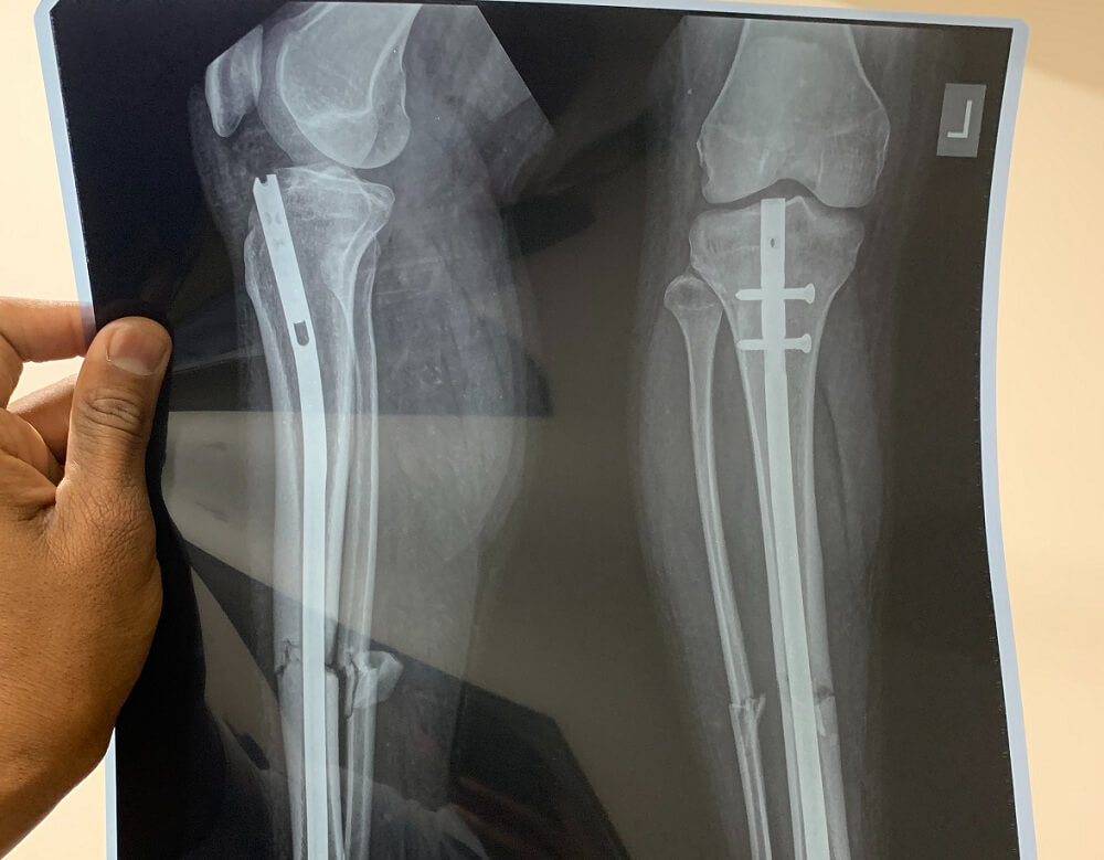 травматолог